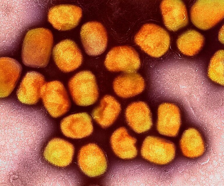 Colorized transmission electron micrograph of the mpox, formerly monkeypox, virus